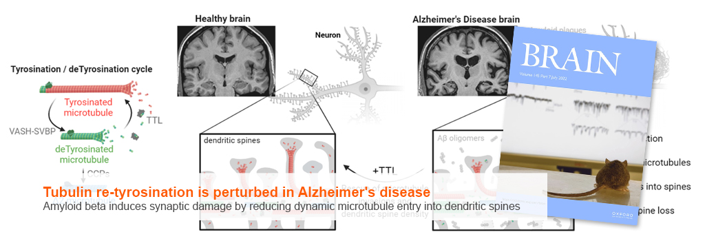 Tubulin re-tyrosination is perturbed in Alzheimer's disease