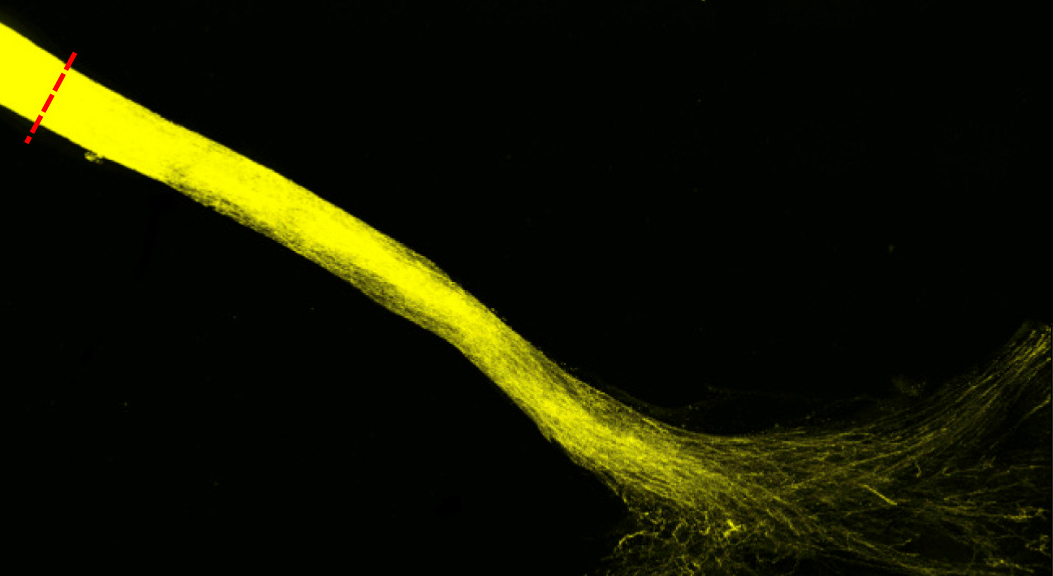 Microscopie fluorescence