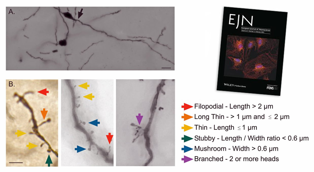 Couverture de l'European Journal of Neurosciences