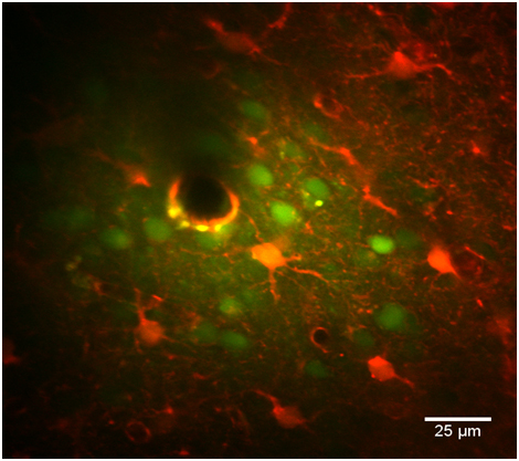 Imagerie calcique sur neurones et astrocytes