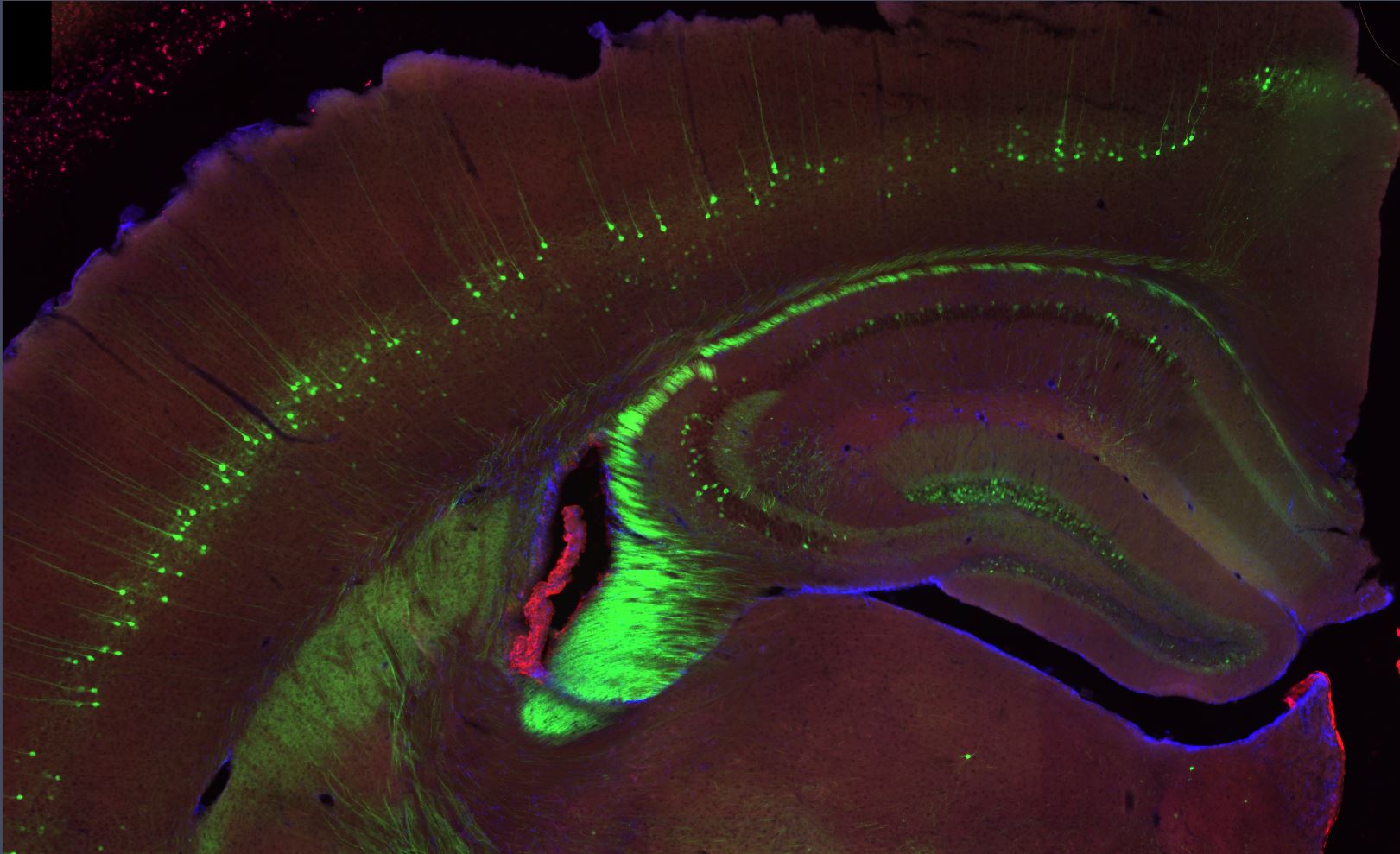 Immunofluorescence d'une coupe de cerveau